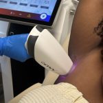 OMNI Permanent Hair Reduction